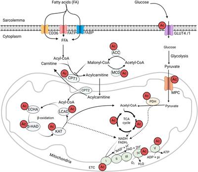 The role of acetylation in obesity-induced cardiac metabolic alterations